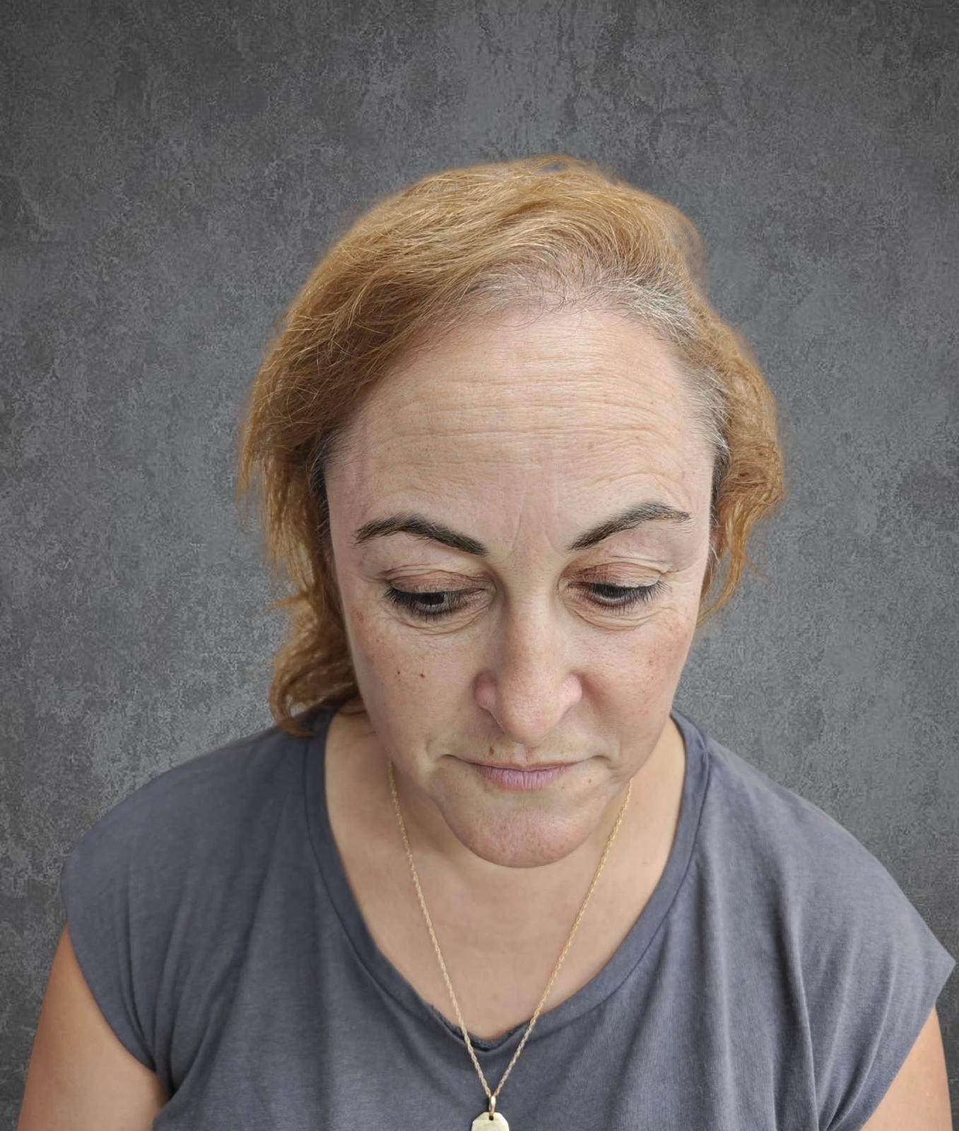 cabeza de mujer con poco pelo 